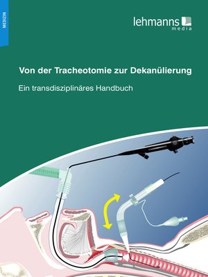 cover image of Von der Tracheotomie zur Dekanülierung